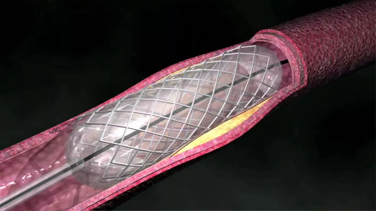 Default image