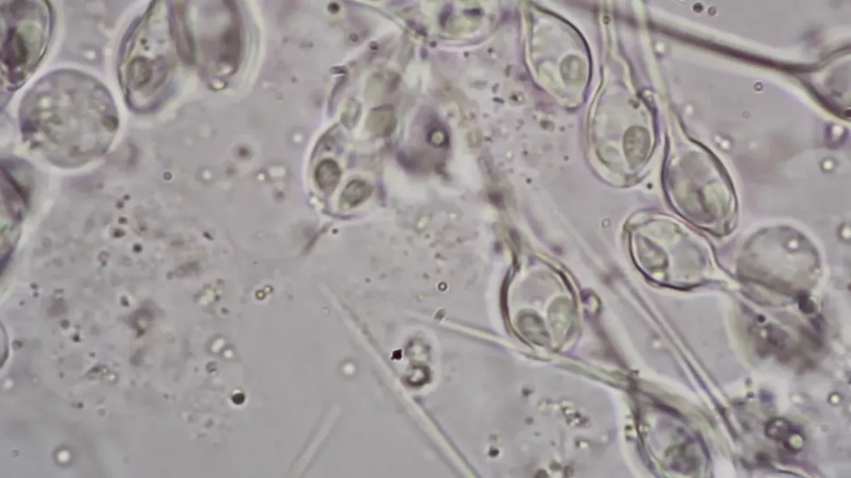 Henneguya salminicola