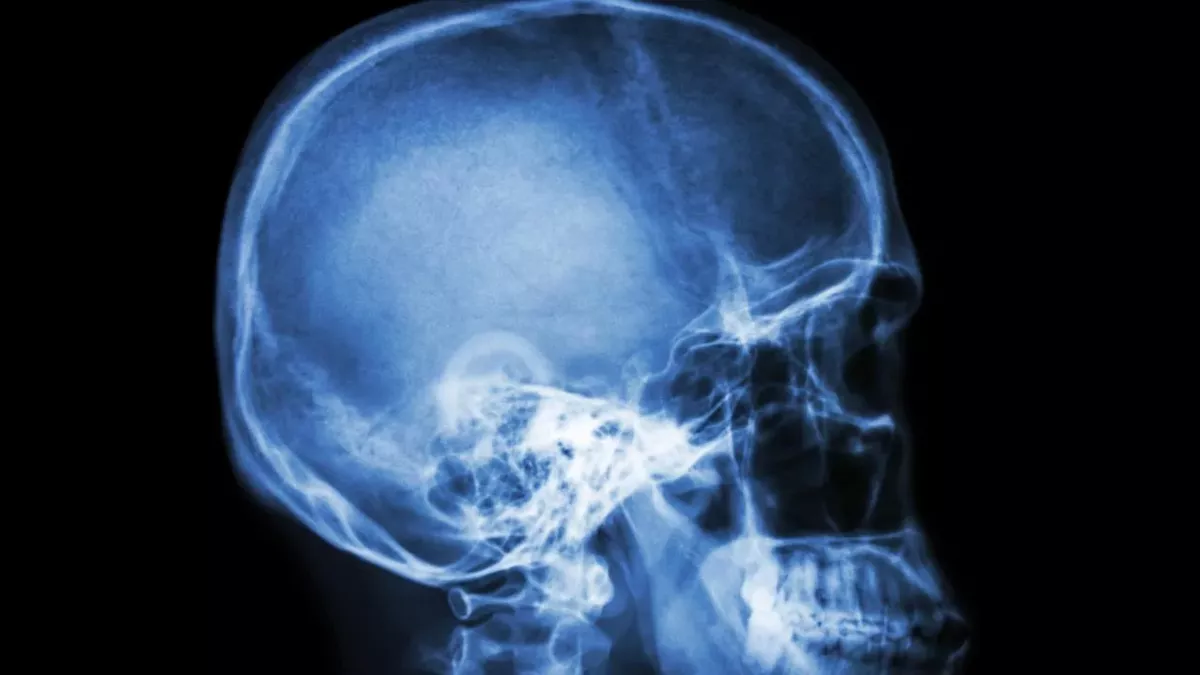 This is how even a mild COVID infection could modify your brain