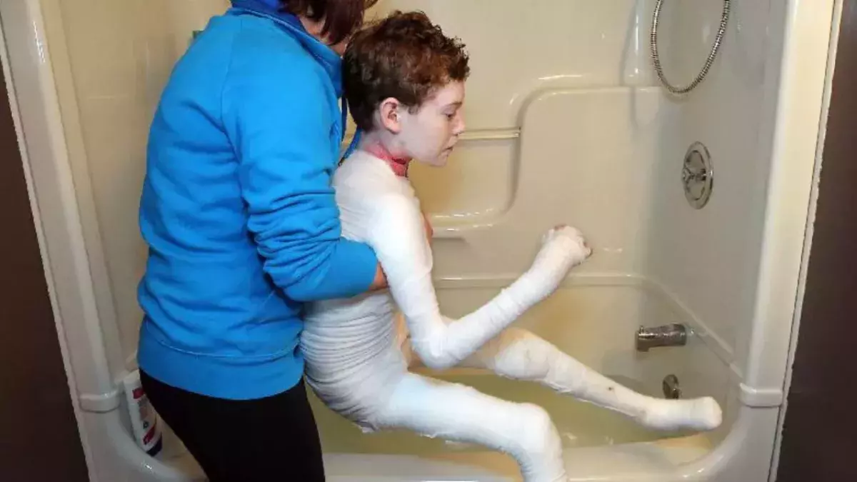 Jonathan Pitre, butterfly child