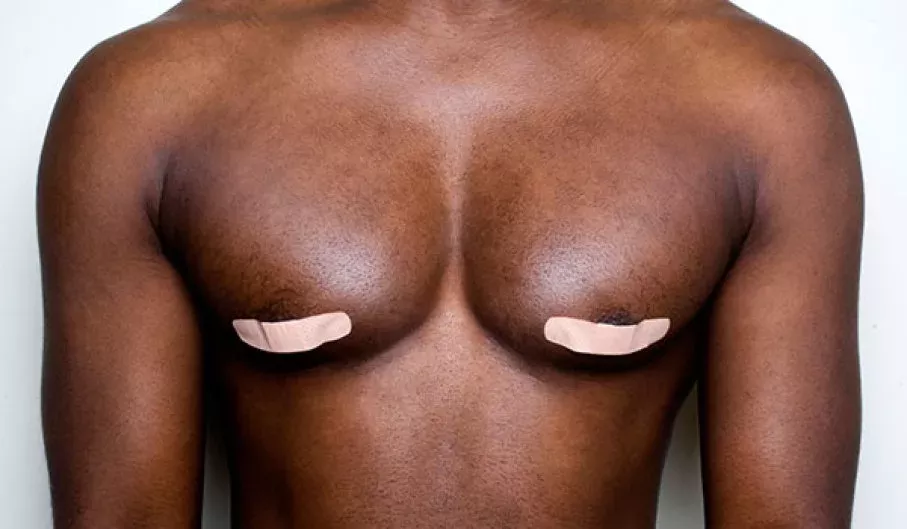 male nipples