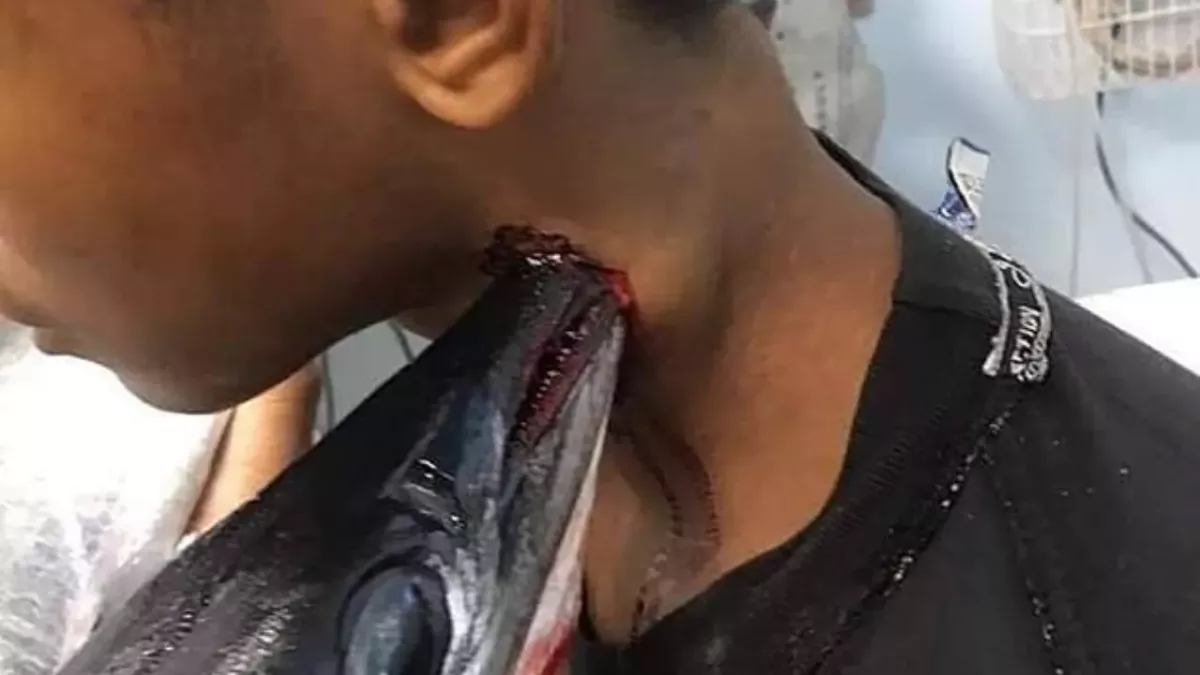 A needlefish attacked Muhammad Idul 