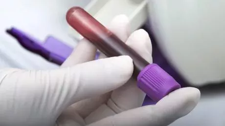 Only 40 people in the world have gold blood, and this allows them to save lives.