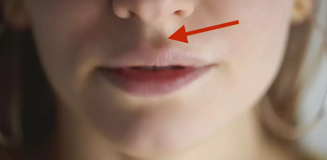 Philtrum