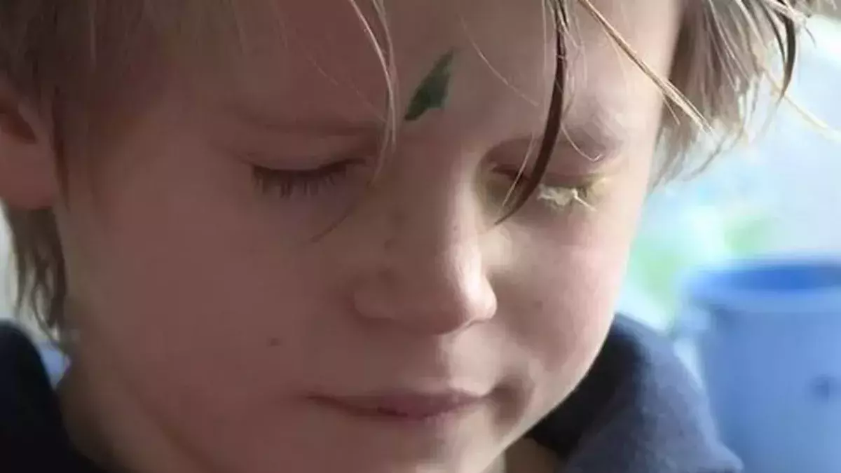 Boy’s eye glued shut for four days after dad mistook superglue for eye drops