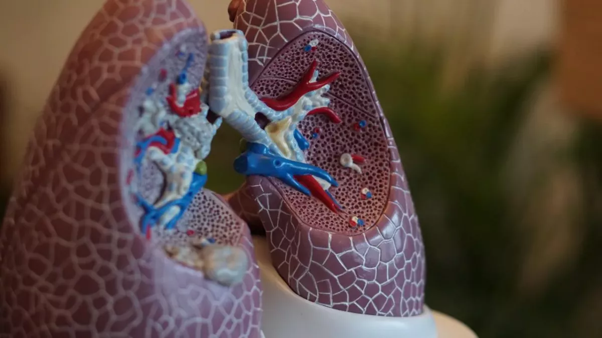 CAT scans reveal COVID damage on people lungs