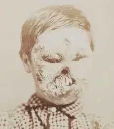 Default image