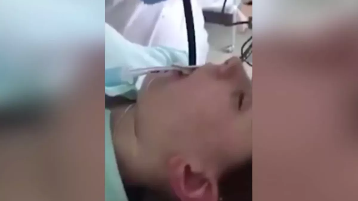 Doctor Removes 4ft Snake After It Slithered Down a Woman's Mouth As She Slept