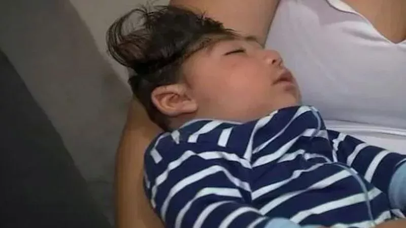 This Is The First Child Born With His Brain Outside Of His Skull