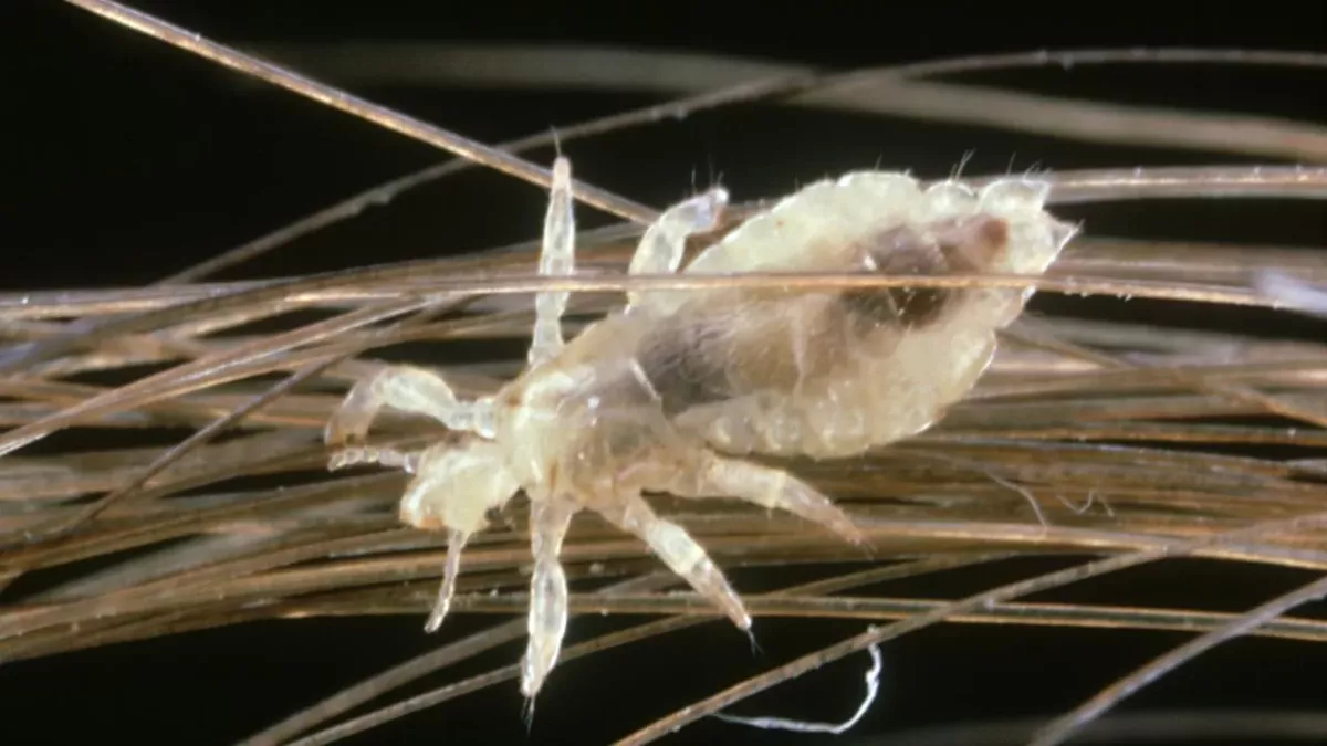 Lice
