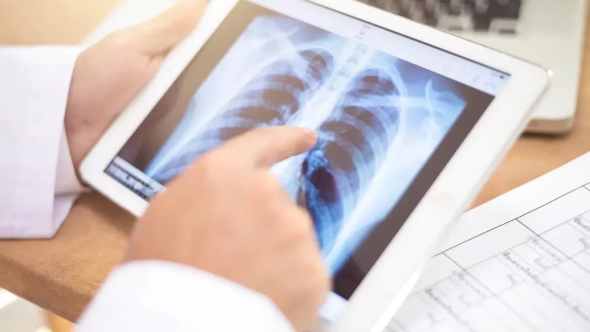 Lung cancer warning signs