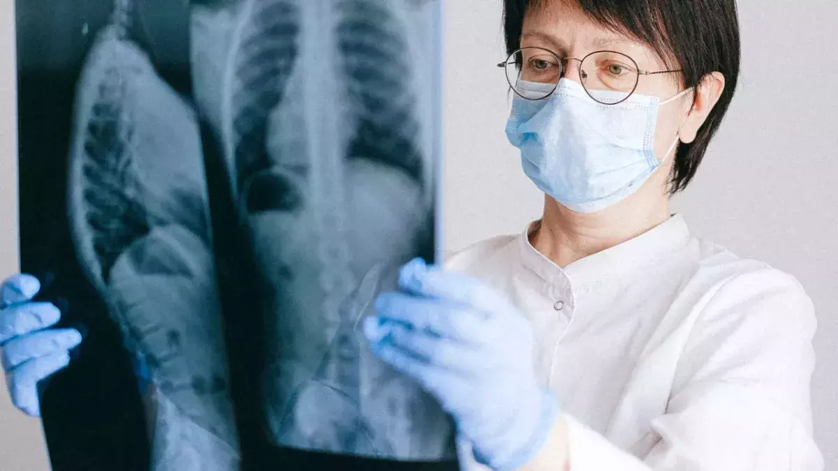 Lung cancer