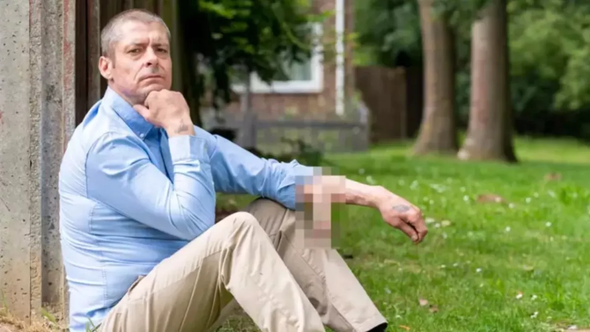 A man had his penis grafted onto his arm