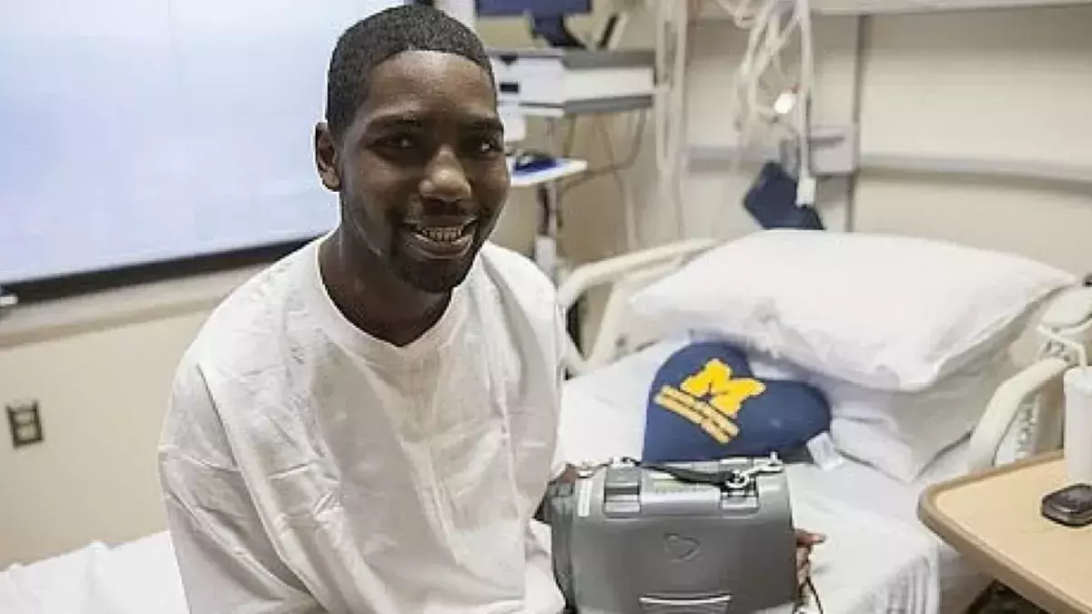 This man lived without a heart for 555 days