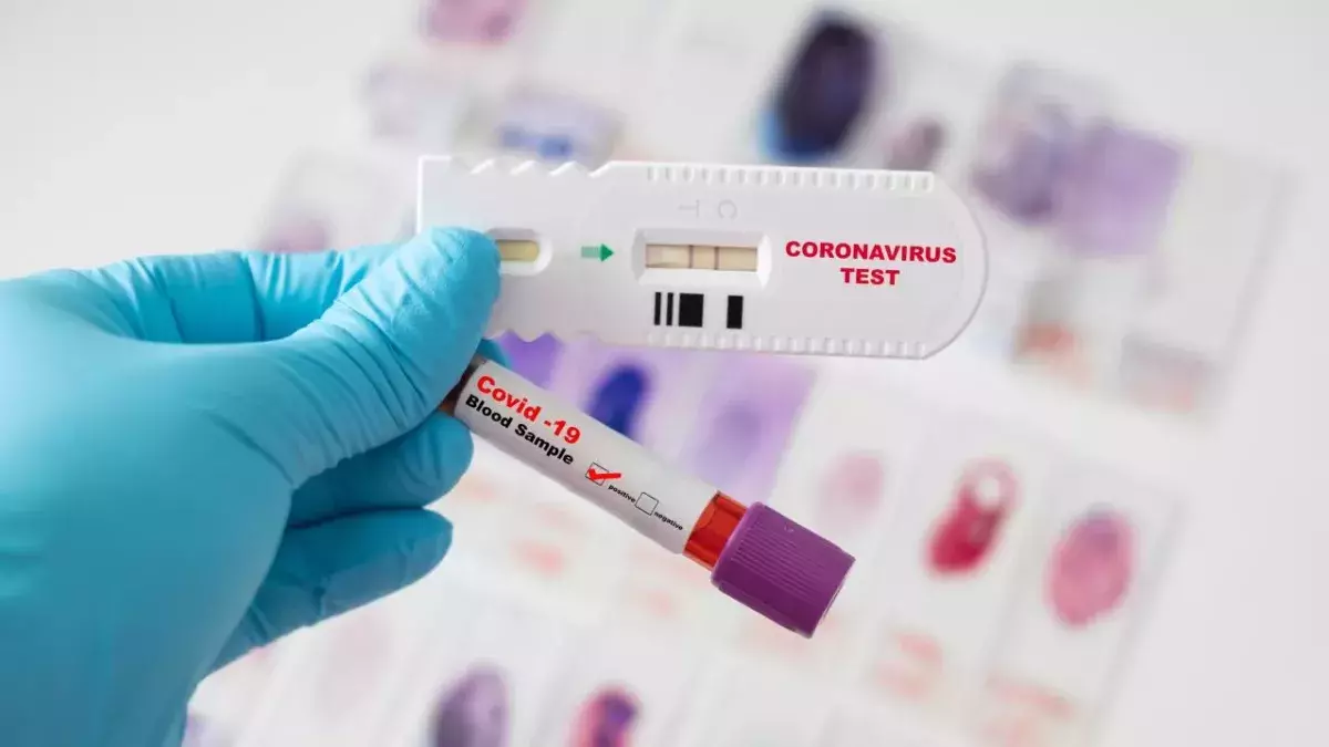 Mass antibody testing hopes to determine why vaccinated people are still catching COVID