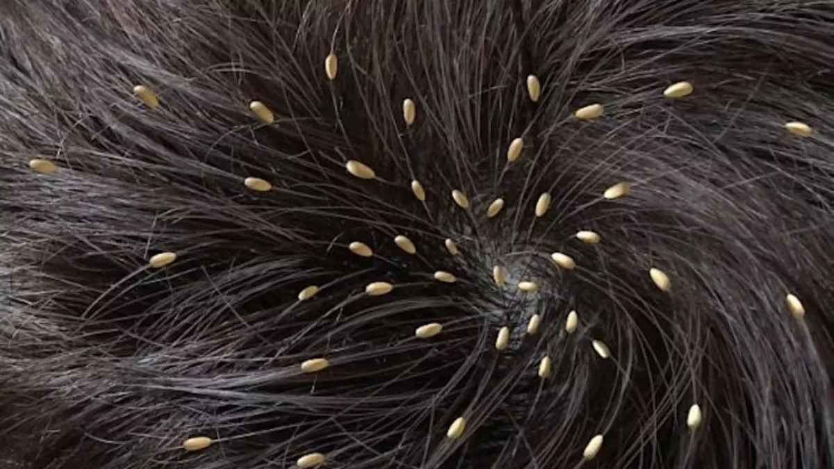 A passenger filmed a woman with a head full of lice