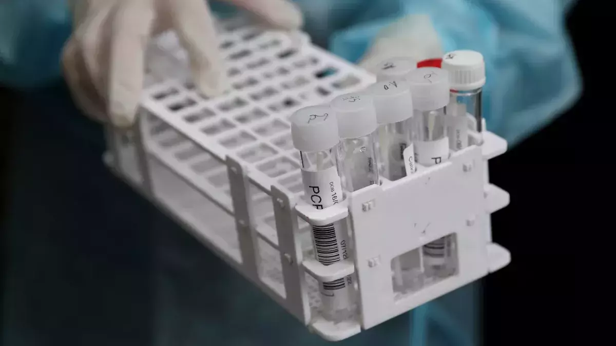 Research finds Omicron present before Delta and Beta variants