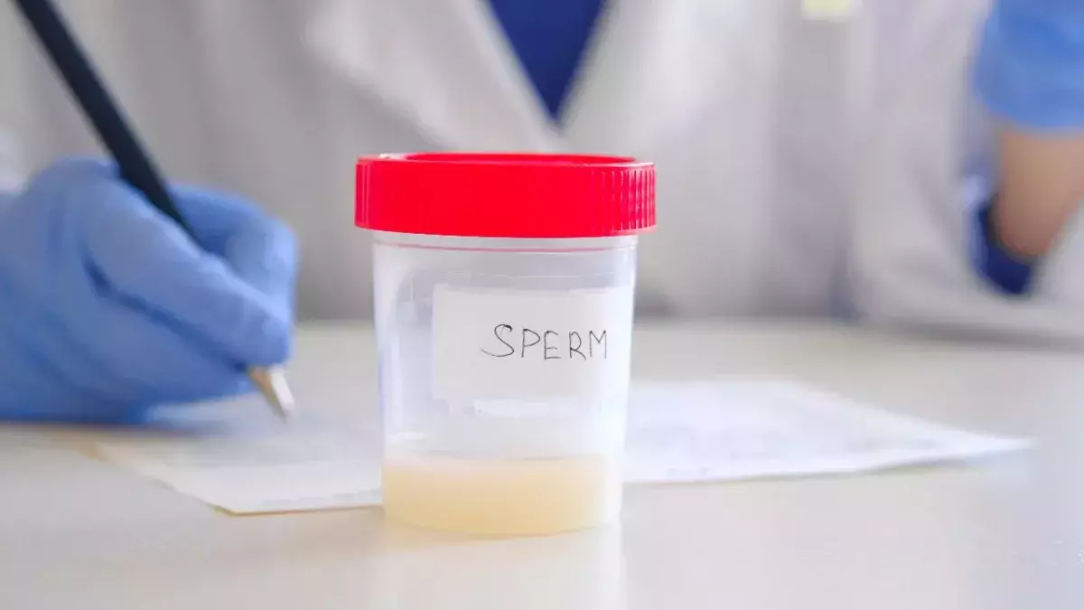 Semen colour
