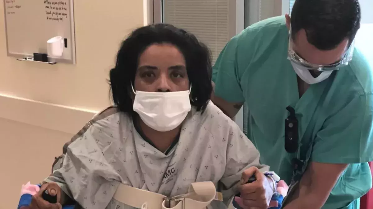 A spider bite on the buttocks costs this woman a leg.