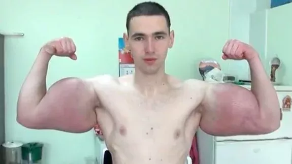 Synthol