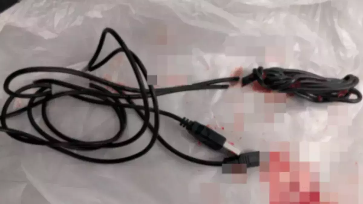 Teenage boy undergoes surgery after sticking knotted USB cable into his penis