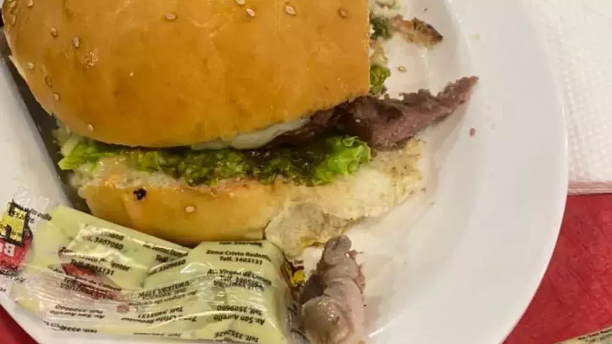 Woman chews on rotting finger while eating hamburger