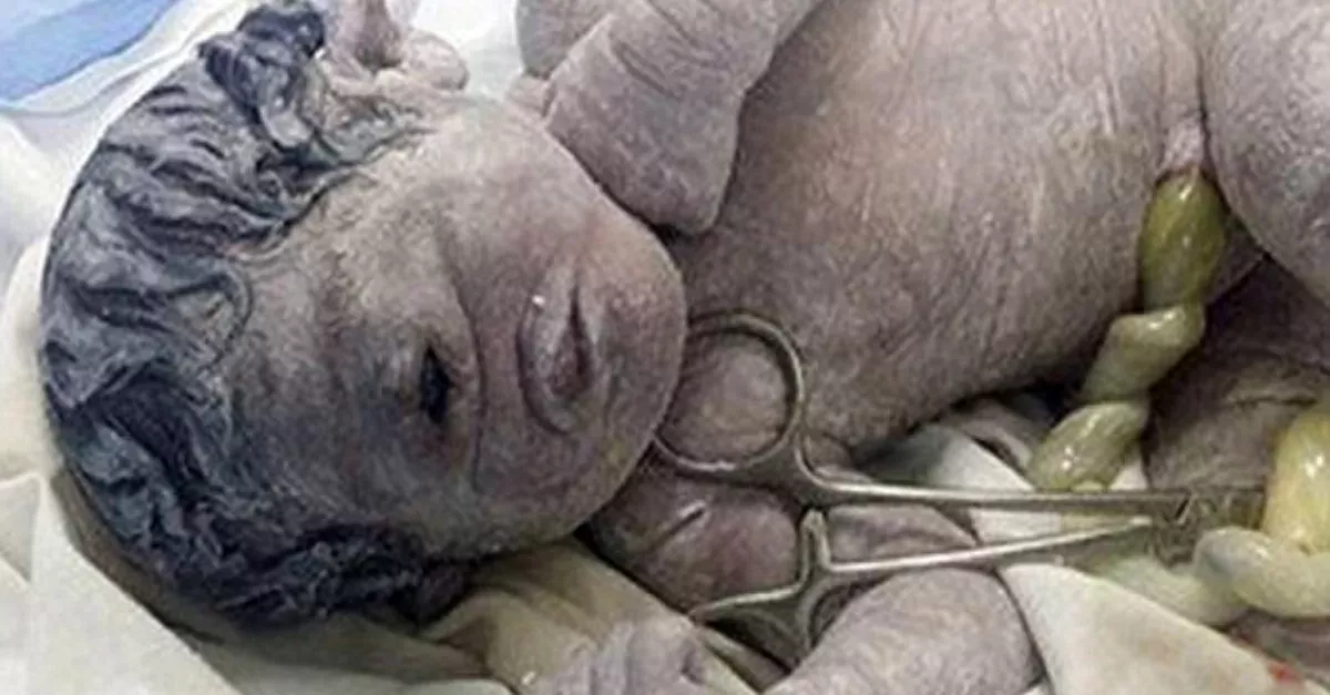 A Woman In Egypt Recently Gave Birth To A ‘Cyclops Baby’