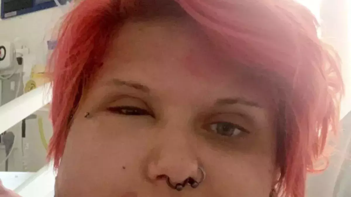 Woman’s face swells to twice the size after brushing against this toxic plant