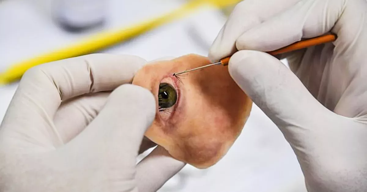 Doctors Craft A Prosthetic For A Woman's Missing Eye With A Phone And A 3D Printer