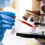 Blood Test