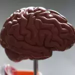 Brain 