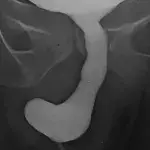 Default image