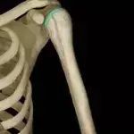 Default image