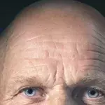 Default image