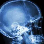 This is how even a mild COVID infection could modify your brain