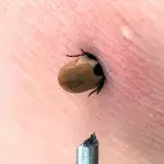 How to react correctly to a tick bite