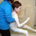 Jonathan Pitre, butterfly child