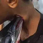 A needlefish attacked Muhammad Idul 