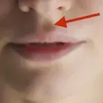 Philtrum
