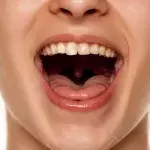 In the same way, these functions can be carried out perfectly well without the uvula