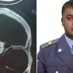Default image