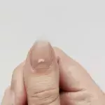 Do you have striated nails? This is what that means