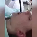 Doctor Removes 4ft Snake After It Slithered Down a Woman's Mouth As She Slept