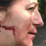 Dog Walker Left Unconscious 