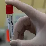 Ethnicity and poverty are high risk factors of death by covid