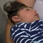 This Is The First Child Born With His Brain Outside Of His Skull