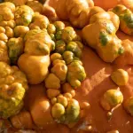 Genital warts