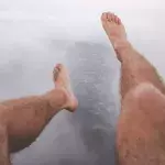 Hair loss on legs could be a sign of this common condition