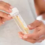 London Mum and Children Drank Urine After Being Told it Cures COVID
