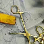 Man swallows entire phone and lived with in stomach for half a year